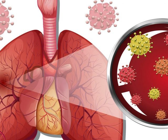 COPD Full Form COPD Stands for Chronic Obstructive Pulmonary Disease