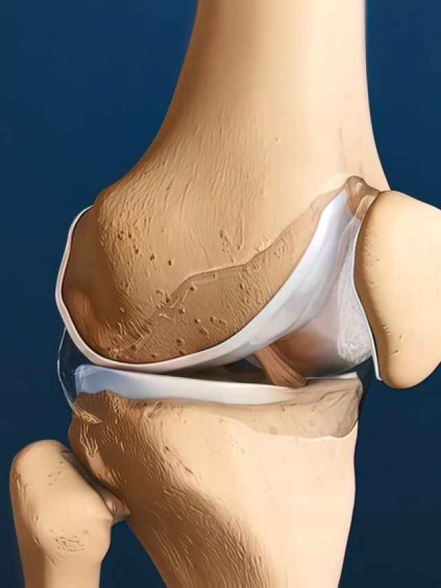 Synovial Fluid Is Present In Aakash BYJU'S Blog